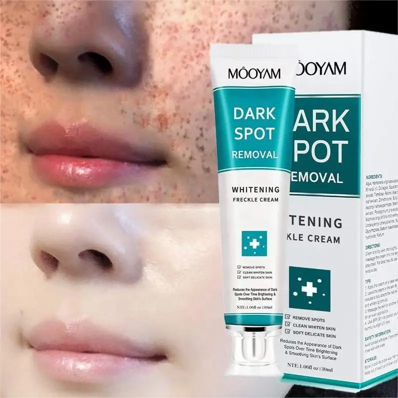 Hot Sale OEM Dark Spot Removal Cream Moisturizeing Brightens the Complexion 30g MOOYAM Whitening Dark Spot Removal Cream