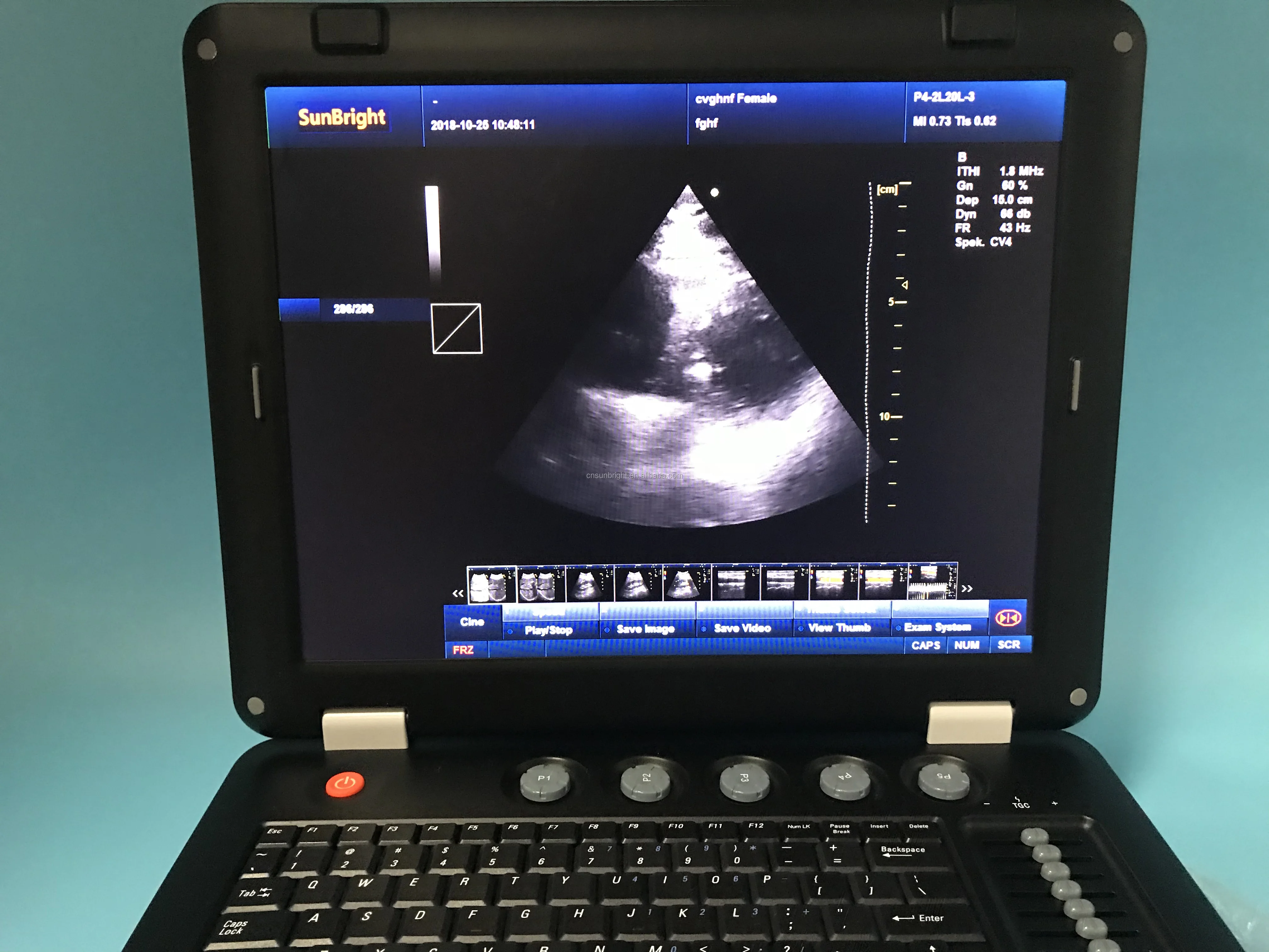 New design for sale Color doppler cheap price ultrasound scan machine sun 906b