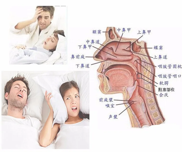 Полость рта против храпа, мундштук для предотвращения апноэ, поднос для бруксизма, помощь при сну, здоровый уход за зубами