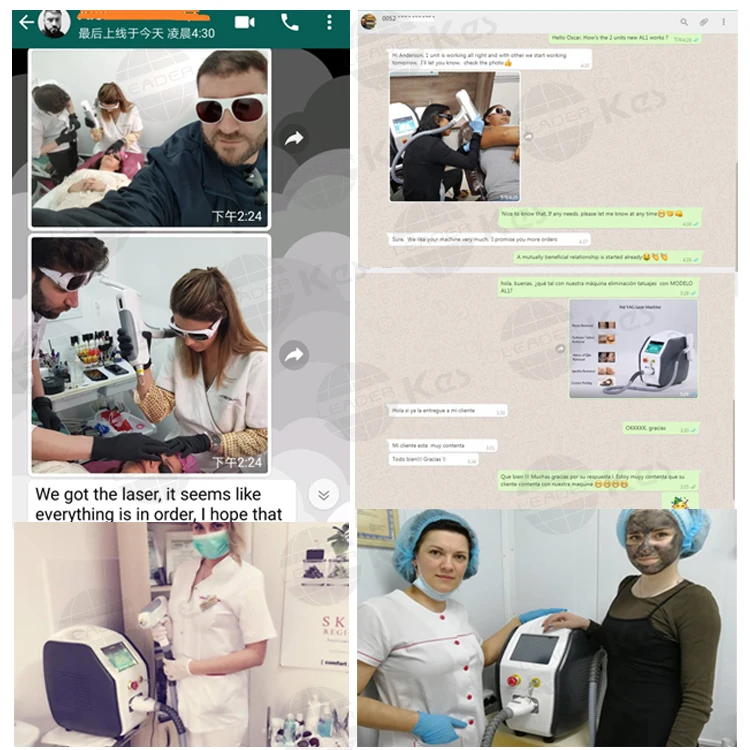 KES 1-1000mj Tattoo Removal Picosecond laser 1064 Nd Yag Laser Price face beauty rejuvenation skin whitening