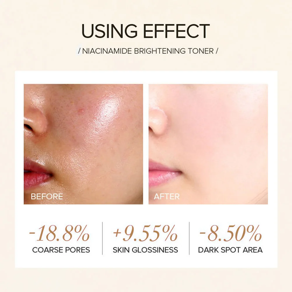 Private Label Natural Organic Whitening Refershing Moisturizing Facial Skin Care Face Niacinamide Rice Rose Korean Skin Toner