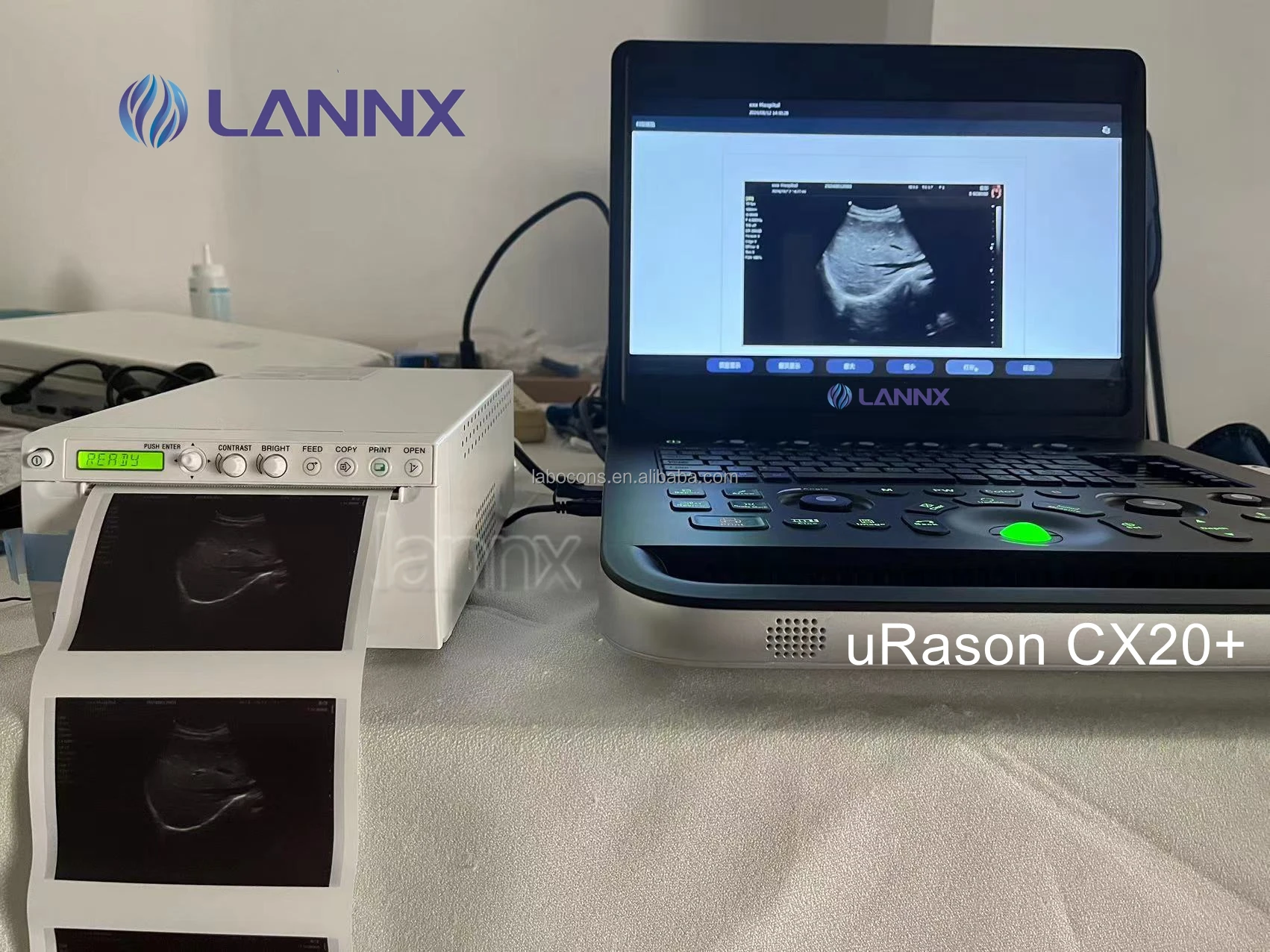 LANNX uRason CX20+ Multipurpose Color Doppler Ultrasound Portable Digital Ultrasonido Laptop 2D 3D ultrasonic Scanner