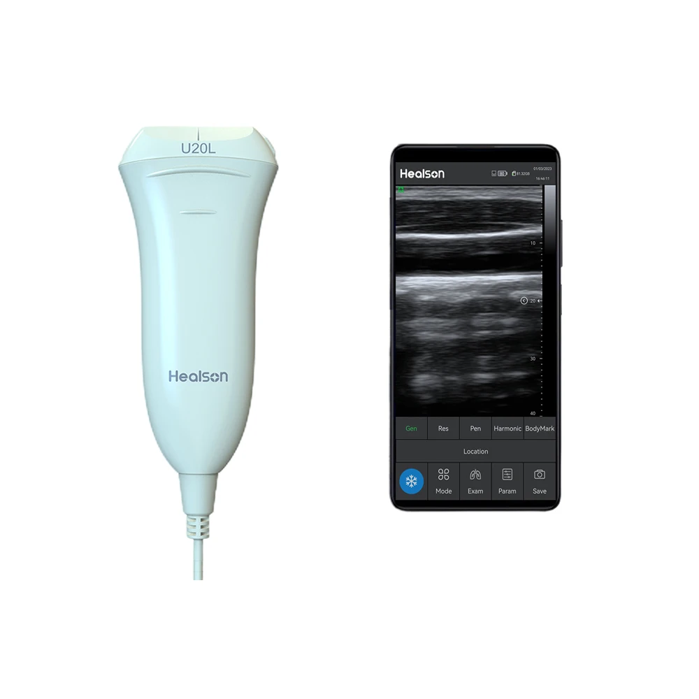U20L USG Full Digital Mini Ultrasound Price Portable Ultrasound Machine Medical Instruments With Smartphone