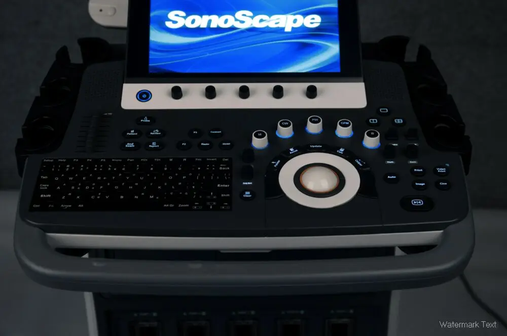 Ультразвук Sonoscape s50 4d лучше чем mindray dc 70