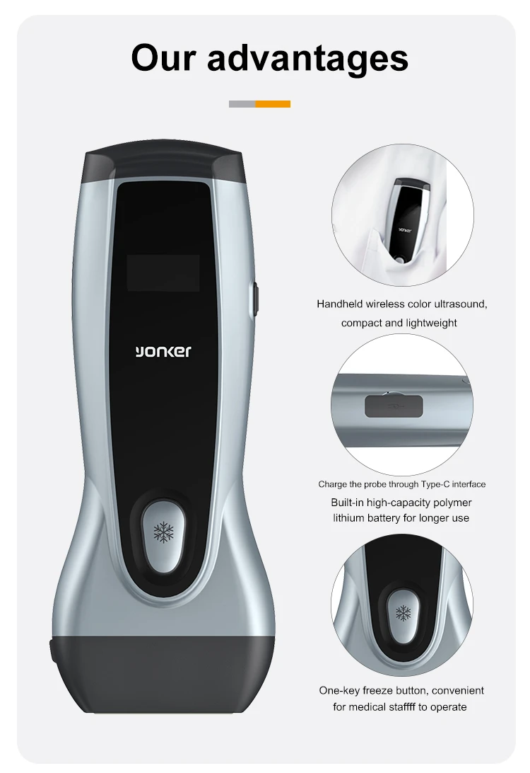 Yonker handheld veterinary medical device wireless usb veterinary doppler ultrasound scanner machine