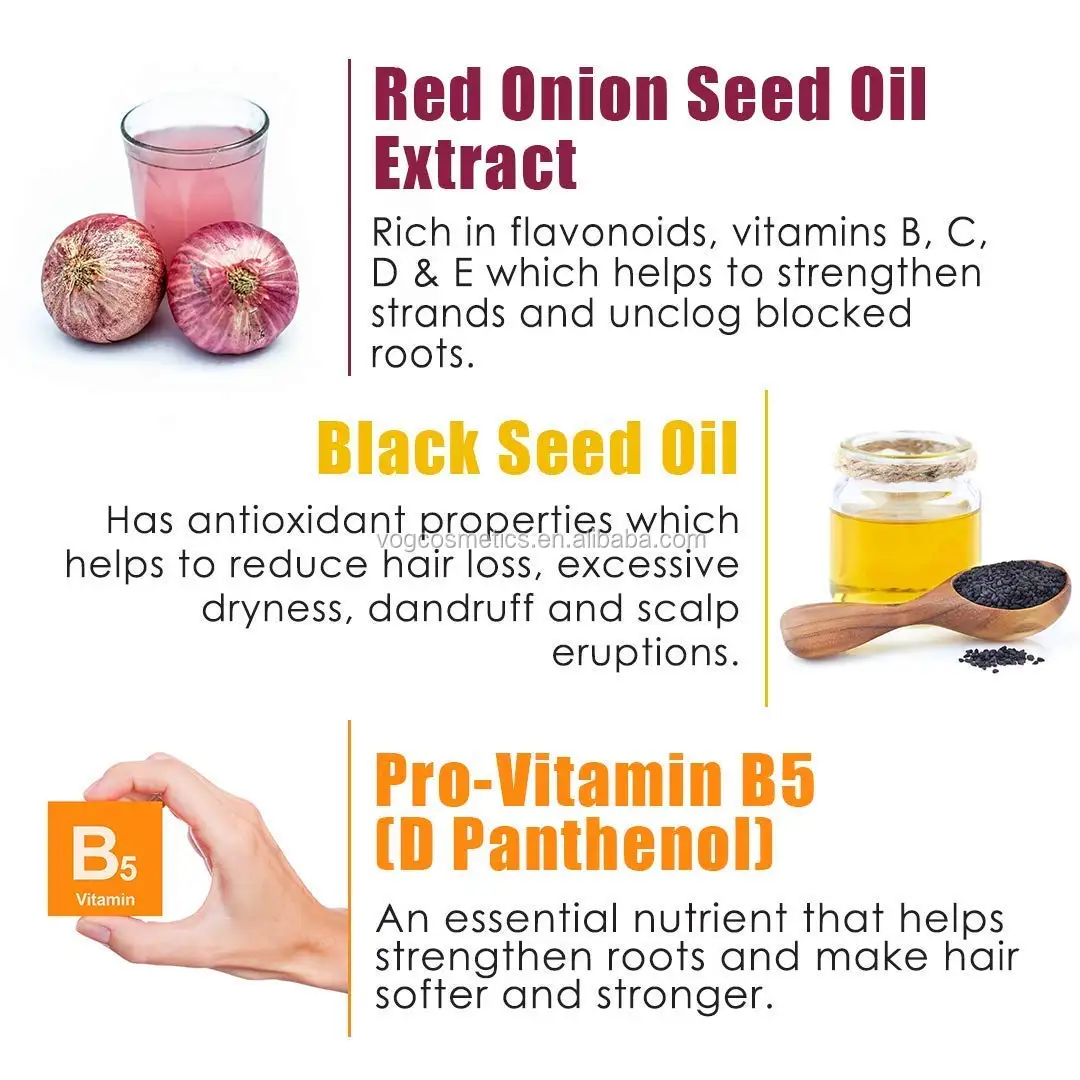 Частная торговая марка против выпадения волос и способствует здоровому росту шампунь с красным луком набор кондиционеров