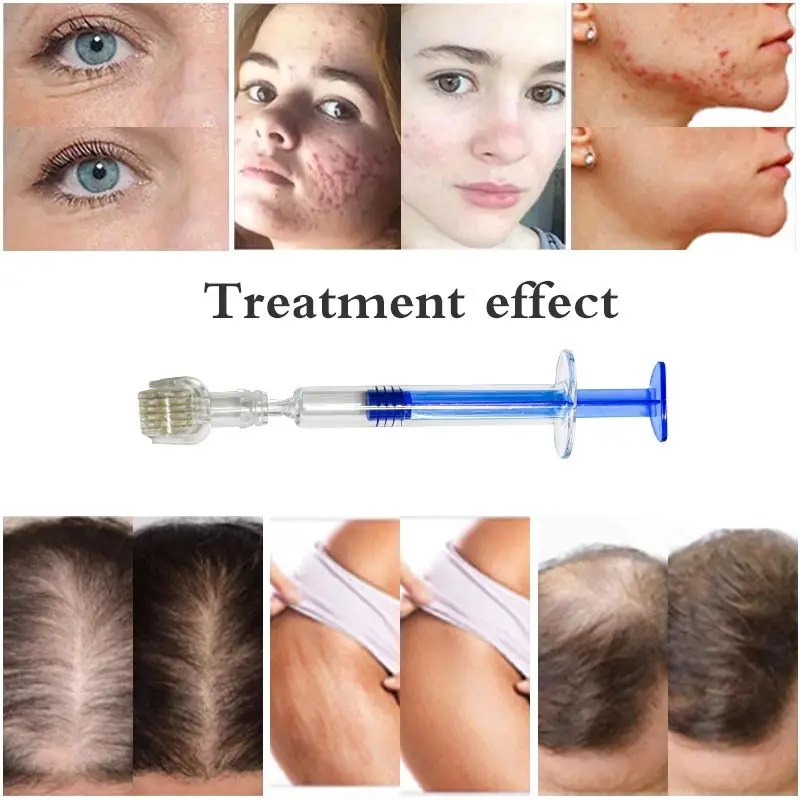 Мезотерапевтический шприц PMU BEAUTY 0 5 мм для мезотерапии Aqua Derma сыворотка-аппликатор ухода за