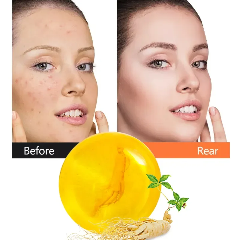 100 g Handmade Soap Ginseng Soap Herbal Oil Whitening Face Body Home Use Soap