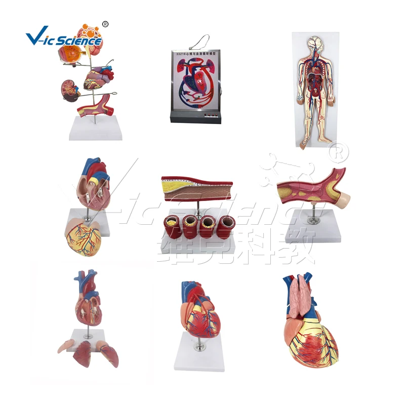 Brain with Arteries 9 Parts temporal and occipital lobes frontal and parietal lobes