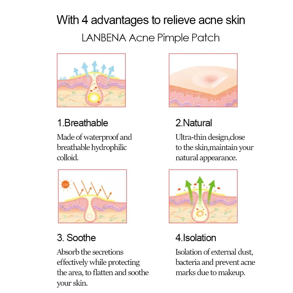 In stock 144 Pcs Acne Pimple Master Patch Waterproof Pimple Patch Hydrocolloid Acne Patch