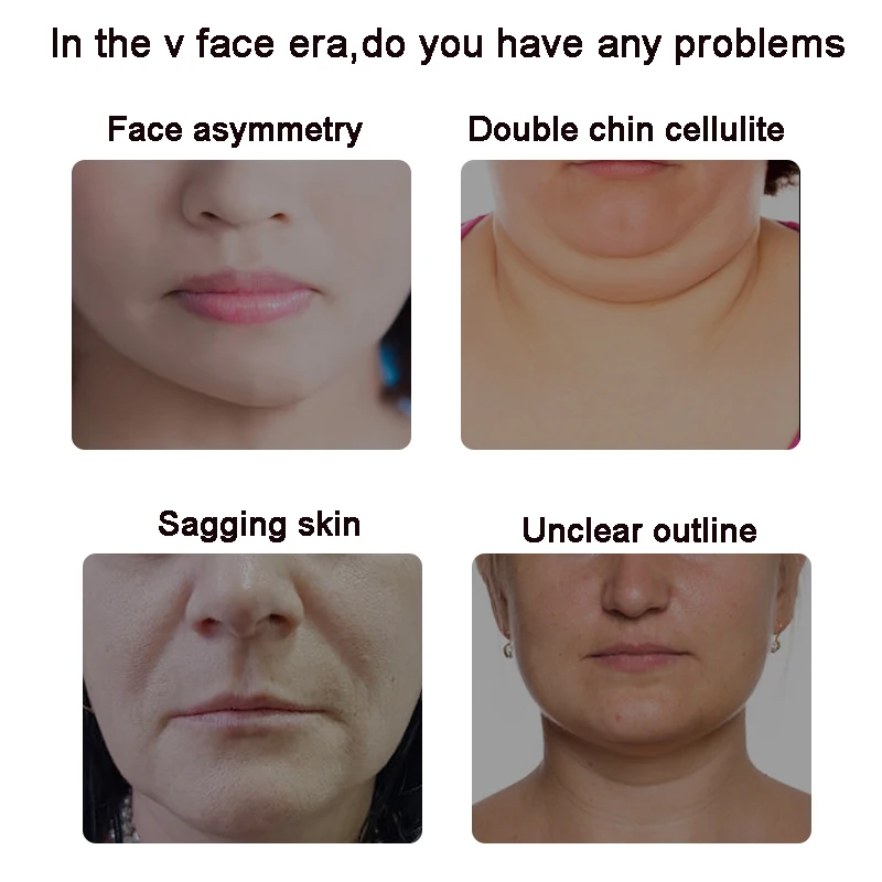 Hot Selling EMS Face Lifting Massager Beauty & Personal Care Tool for Effective Face Massaging