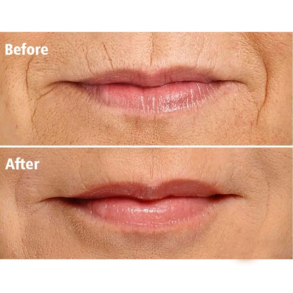 16 шт. силиконовых кейсов крем для лица против морщин и патчи для лица средство для борьбы с морщинами полоски многоразовые Лоб глаз стикеры Чин против морщин патчи