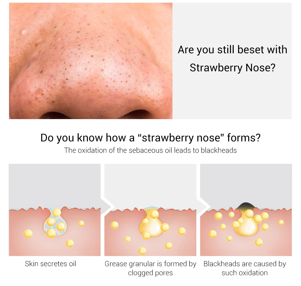 LANBENA Black head Remover Nose Black Mask Face Care Mud Acne Treatment Peel Off Mask Pore Strip Skin Care Peel Mask Oil Control