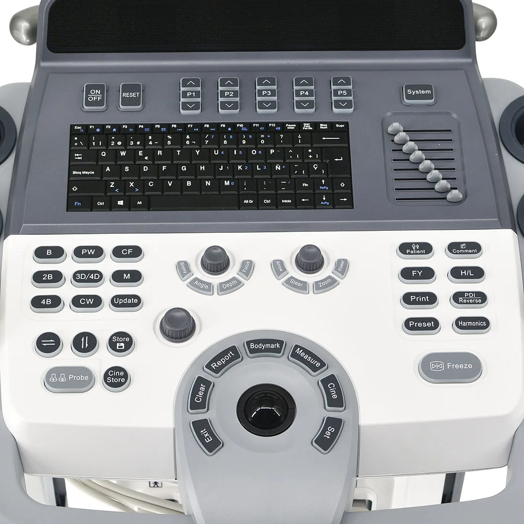 Горячая Распродажа Мобильный аппарат фибросканирования 2D PW THI тележка Цветной Допплер ультразвуковой