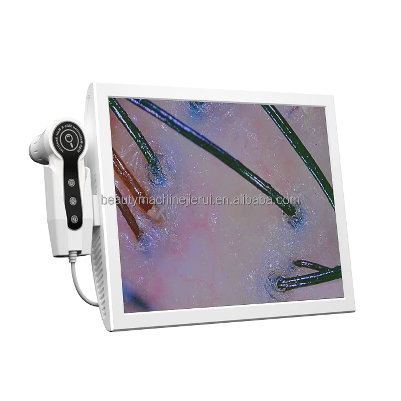 4 lens laptop type skin analyzer and hair scalp follicle enlarge analysis machine with two camera