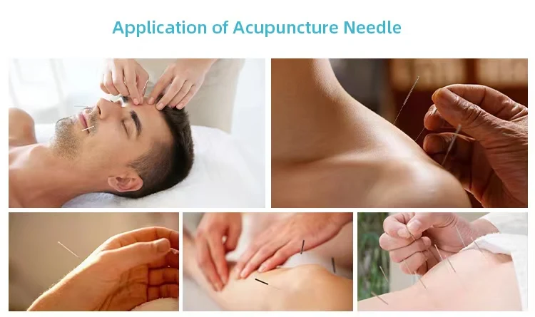 Good Quality Factory Price OEM Chinese Traditional Disposable Sterile Acupuncture Needle with Tube