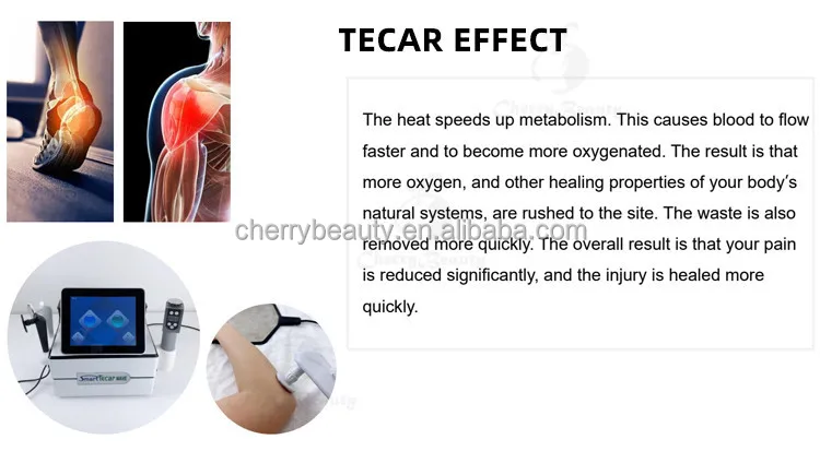 Tecar Ems Physical Pain Relief Indiba Physio Tecar Radiofrecuencia Diathermy 448khz cet ret tecar physical therapy physiotherapy