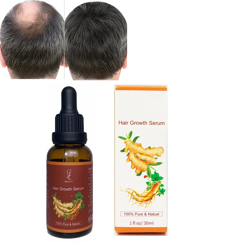 Private label croissance de cheveux herb ginger castor capsules natural hair growth oil