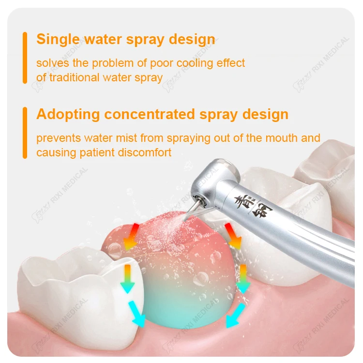 Dental Handpieces Dental Equipment Ceramic Cartridge LED High Speed Surgical Handpiece