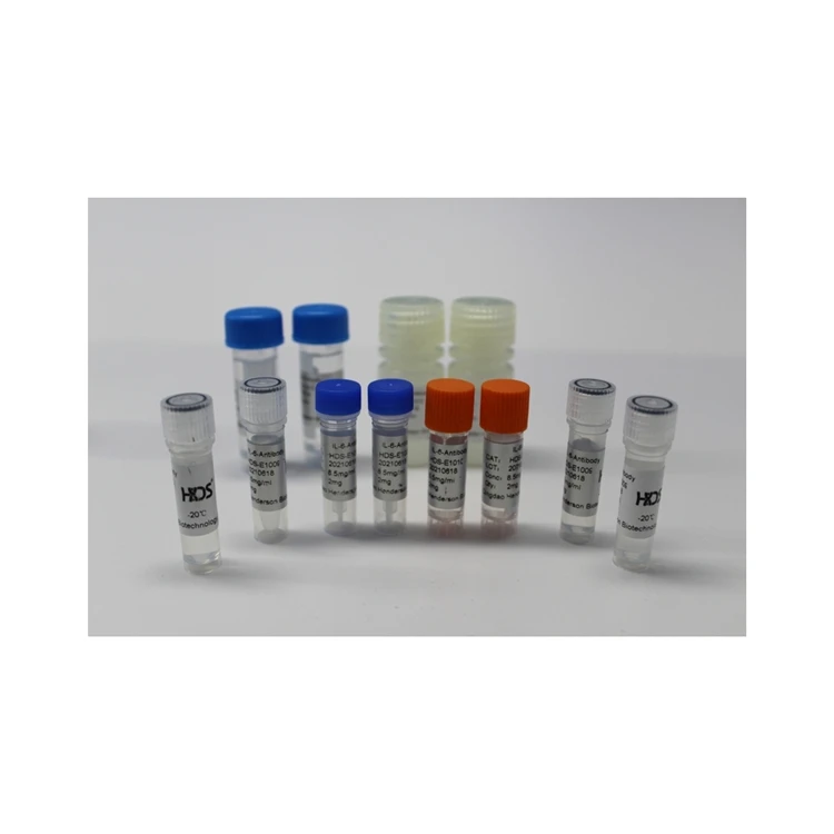 Direct Selling fast reaction home rapid diagnostic kit Interleukin 6 Test Kit ( IL-6) Immunofluorescence Test Kit