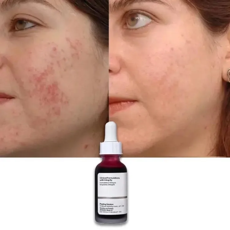 OEM ODM Skin Care Low MOQ Face Serum AHA BHA Niacinamide Zinc Hyaluronic Acid B5 Retinol Facial Serum Caffeine EGCG Eye Serum