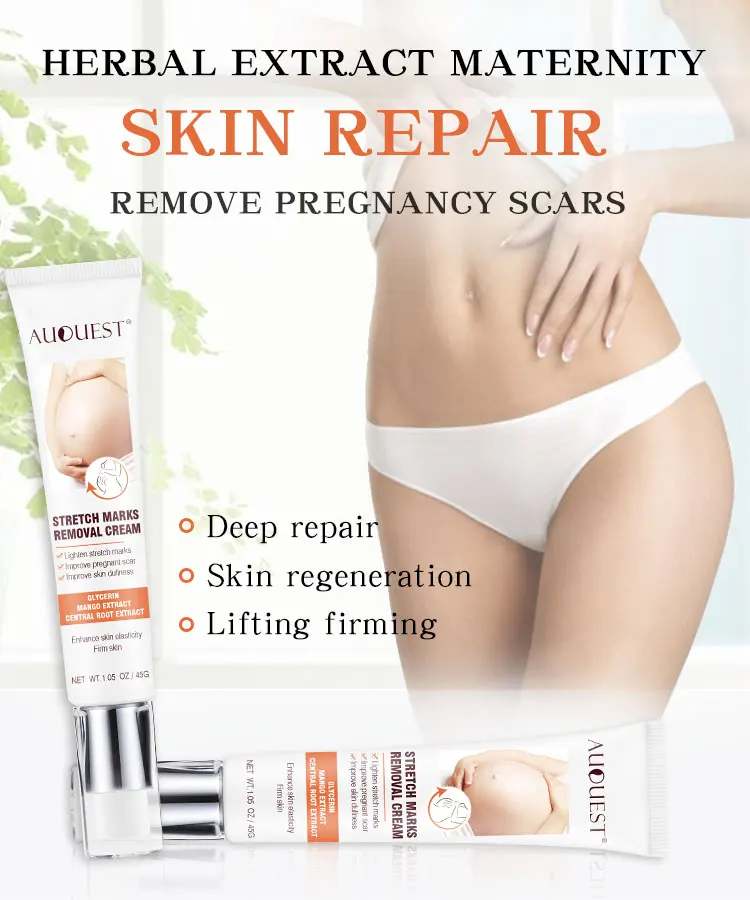 
New arrival stretch marks removal cream and tighten skin repair OEM 