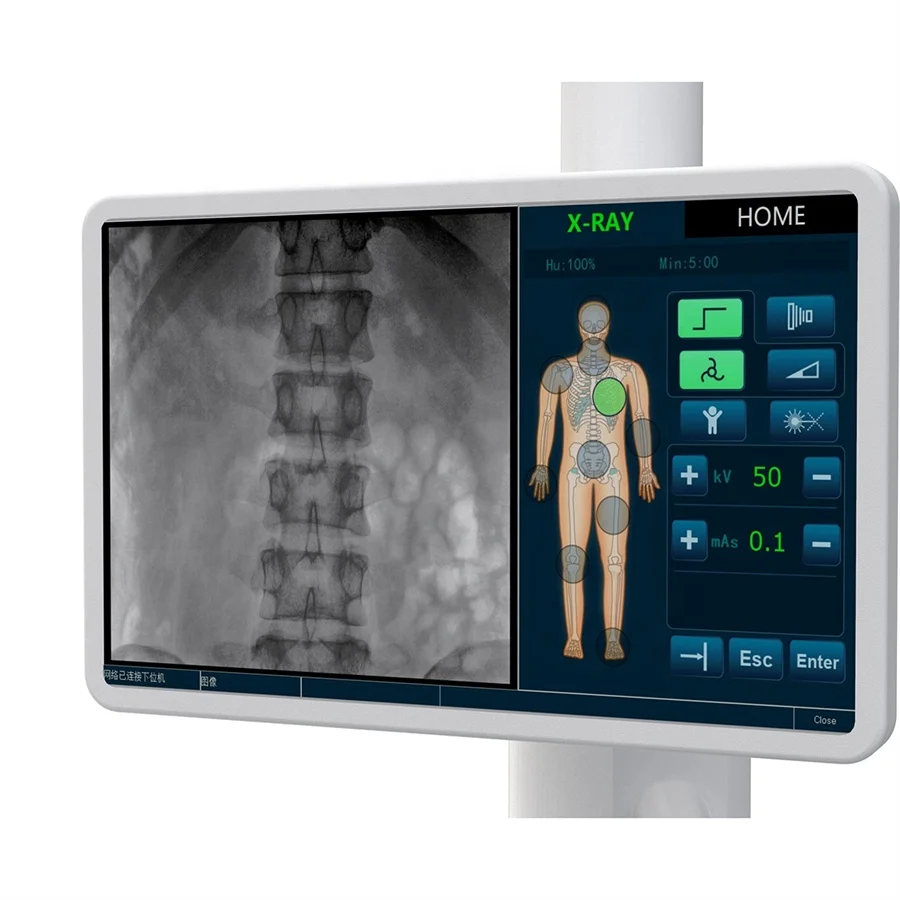 100mA C Arm X Ray Machine Price/ Radiology Scanner C Arm Fluoroscopy Machine