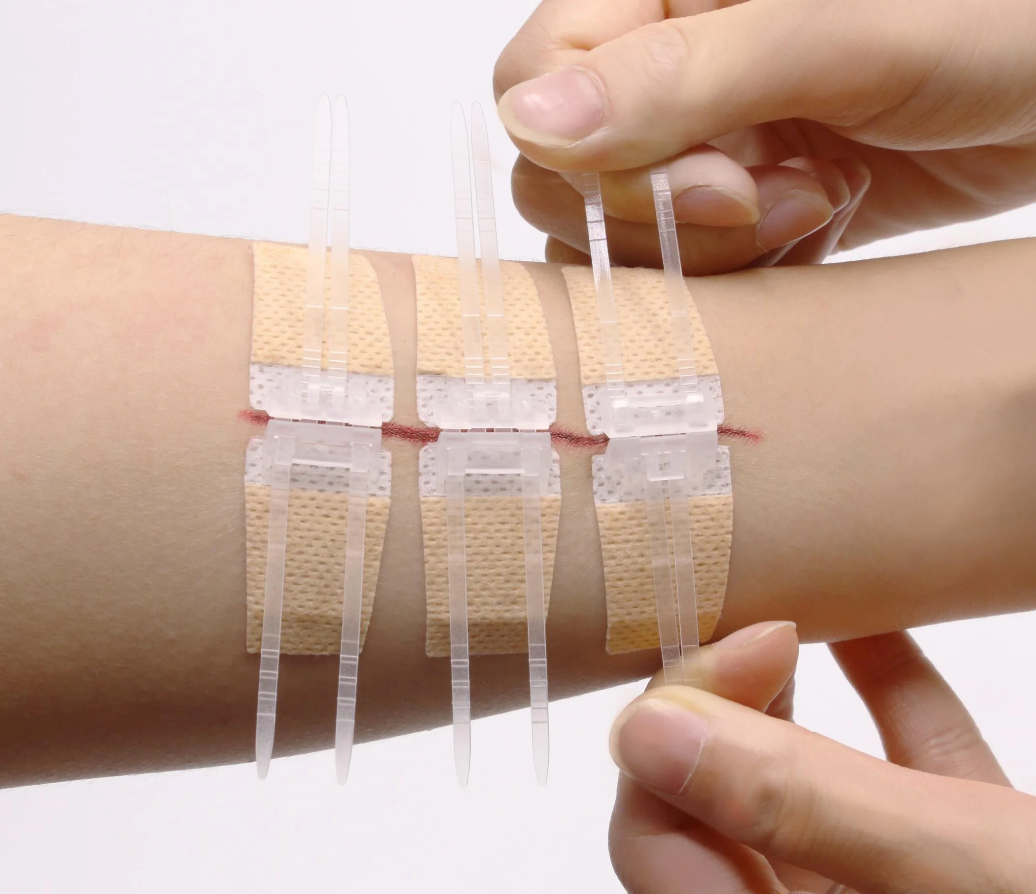 
Disposable Medical Supply Skin Glues Stapler Surgical Tape Wound skin adhesive wound closure device 