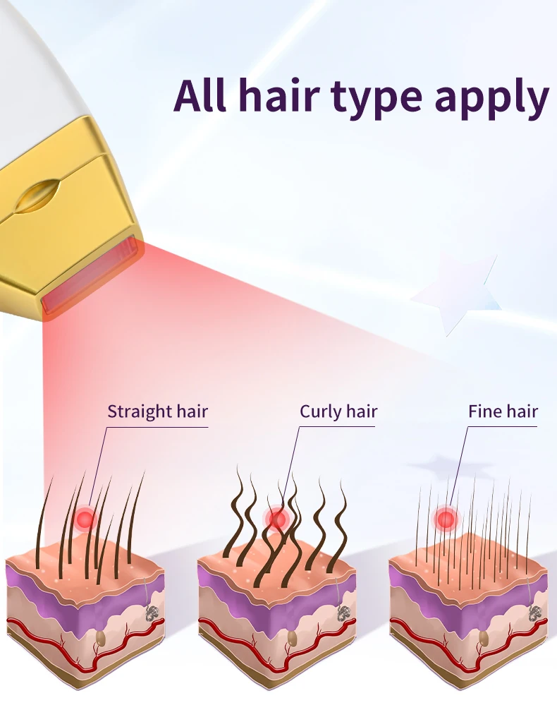 755 810 1064 diode laser hair removal machine big power diode laser 810nm ice titanium laser 3 wavelength