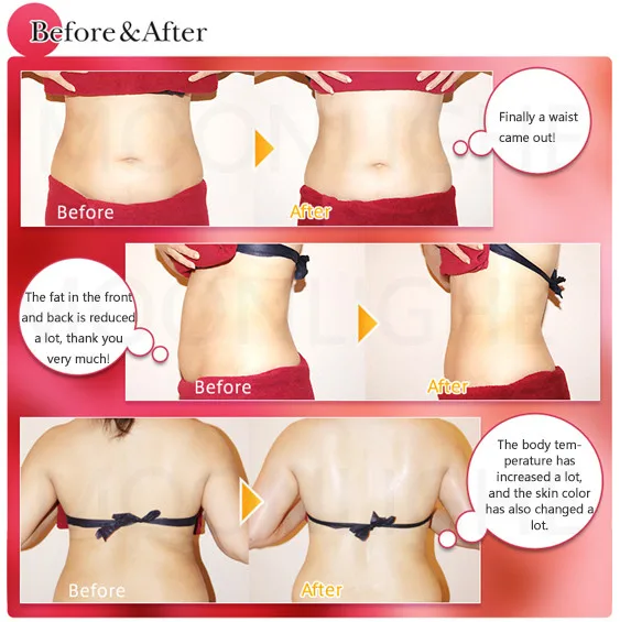 Facial and Body Indiba Radio Frequency 2023 Physiotherapy 448khz Fat Reduction Weight Loss Skin Care