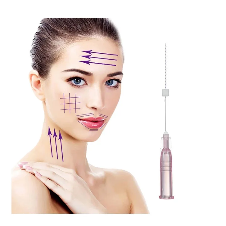 V lifting thread absorbable facial thread lift face price