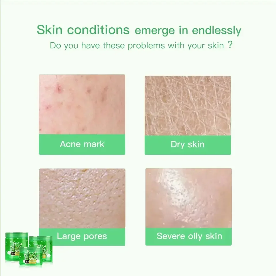 Pure Organic Aloe Vera Gel Aloe Vera Gel Natural Face Creams Soothing  Skin Repairing Moisturizing Aloe Vera Gel