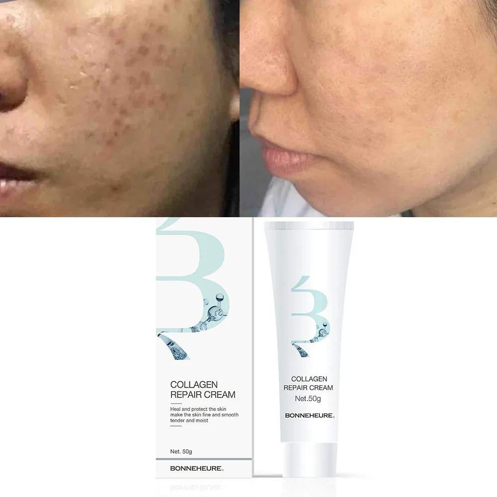 Face Skin Whitening Cream Tube Beauty Anti Aging Skin Whitening Moisturizing Collagen Skincare Face Repair Cream