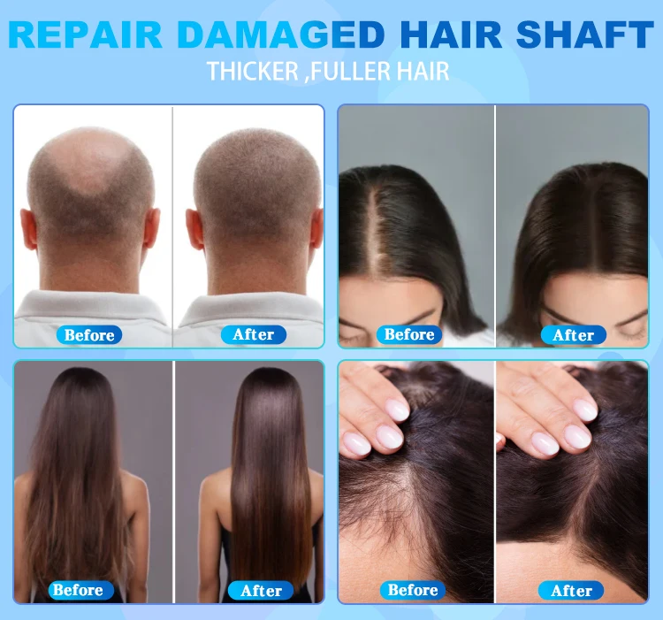 multifunctional stores pictures skin analyzer 2 HD detector camera 50X 200X portable hair scalp analysis machine