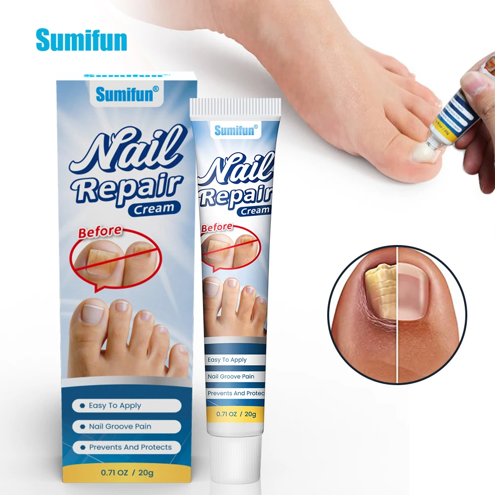 Sumifun Nail Fungus Removal Cream Fungal Treatment Care Ointment 20G