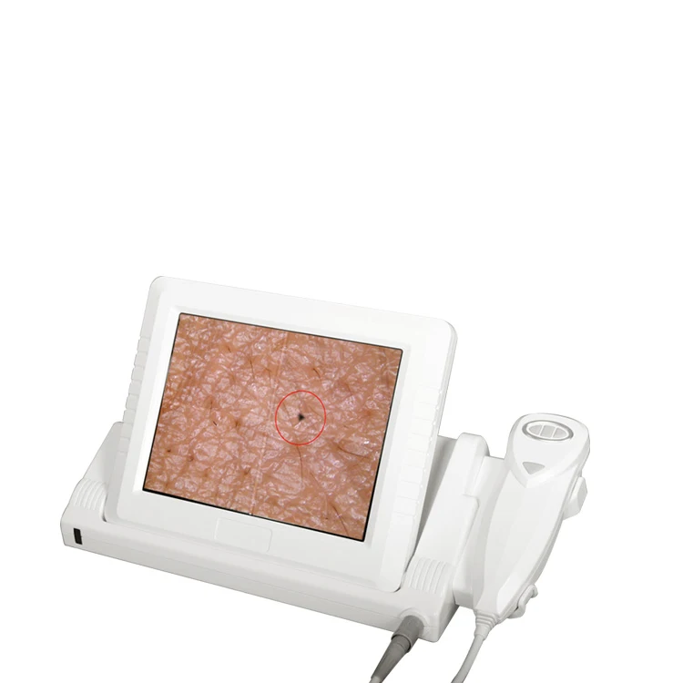 AYJ-J015(CE) 5mp iriscope iridology camera skin test and hair test machine with USB digital iriscope