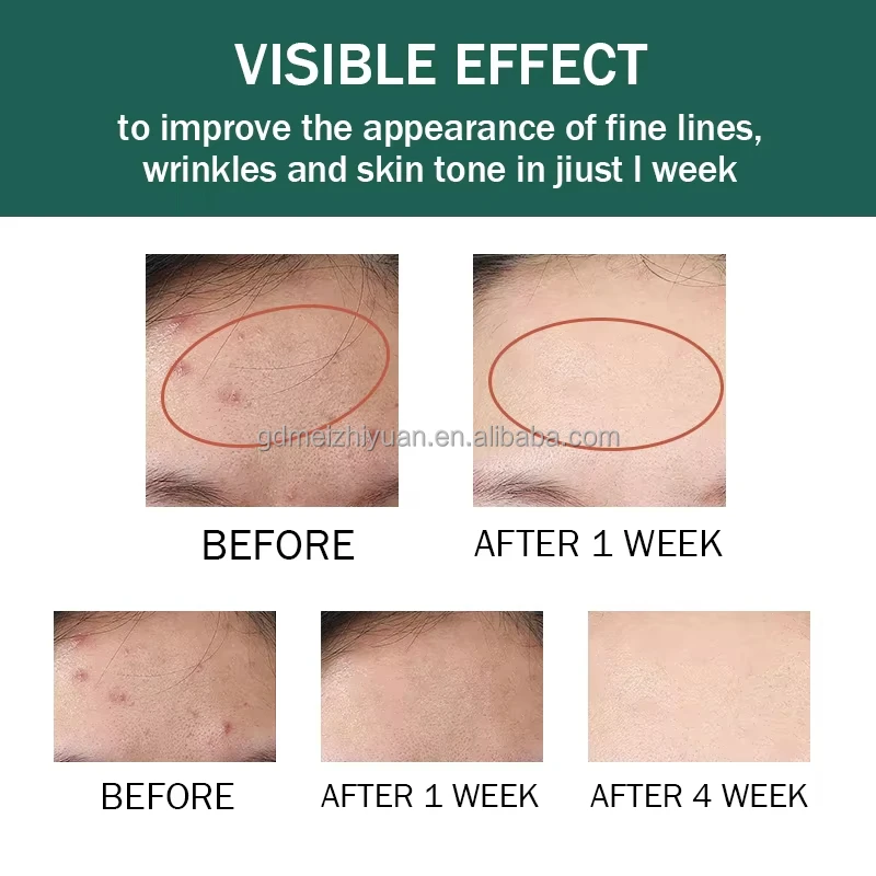 Organic Private Label Pimples And Dark Spot Remover Cream Underarm Cream For Armpit