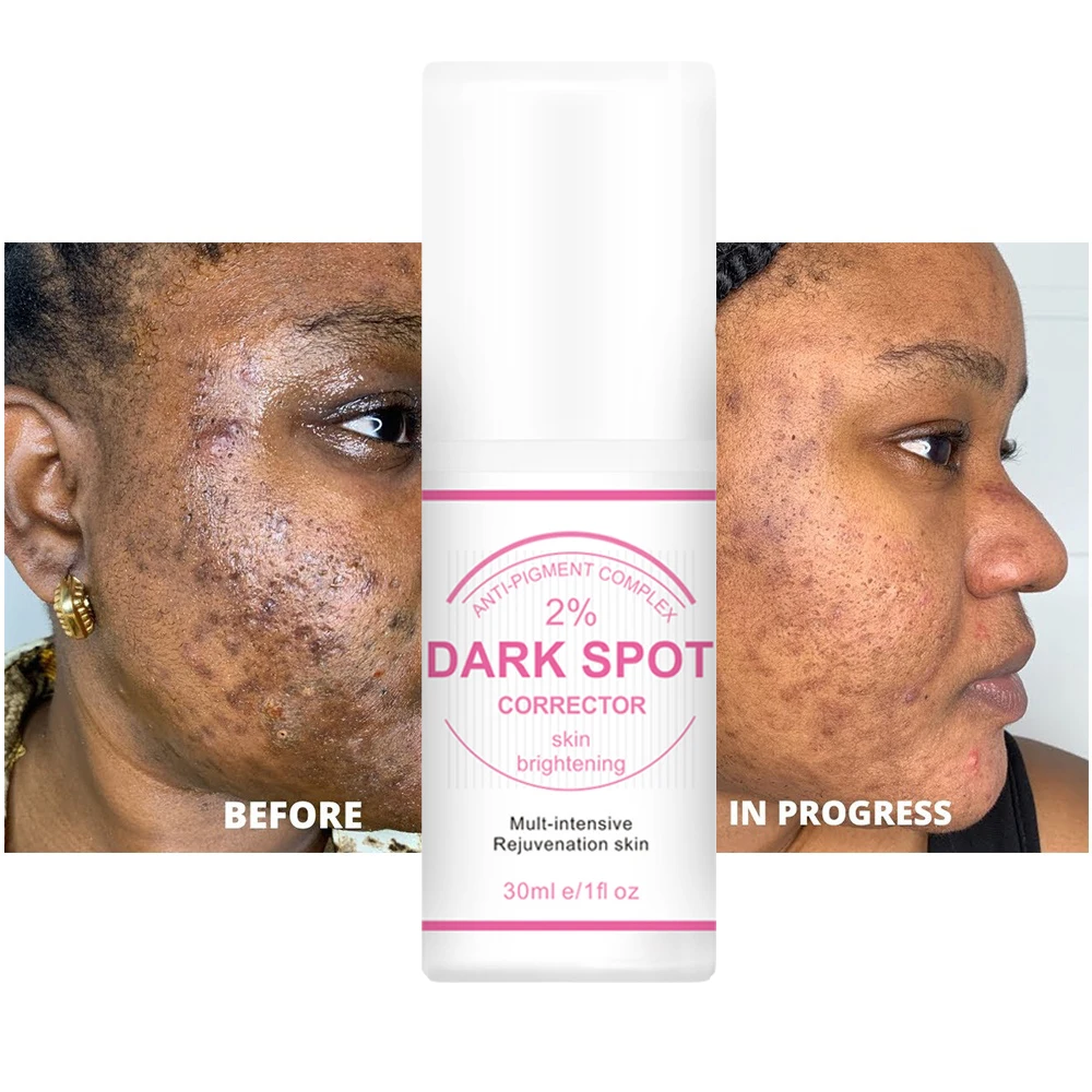 private label Best Korean Whitening Crean Niacinamide Fast Lightening Body Underarm Permanent Skin Whitening Dark Spot Corrector