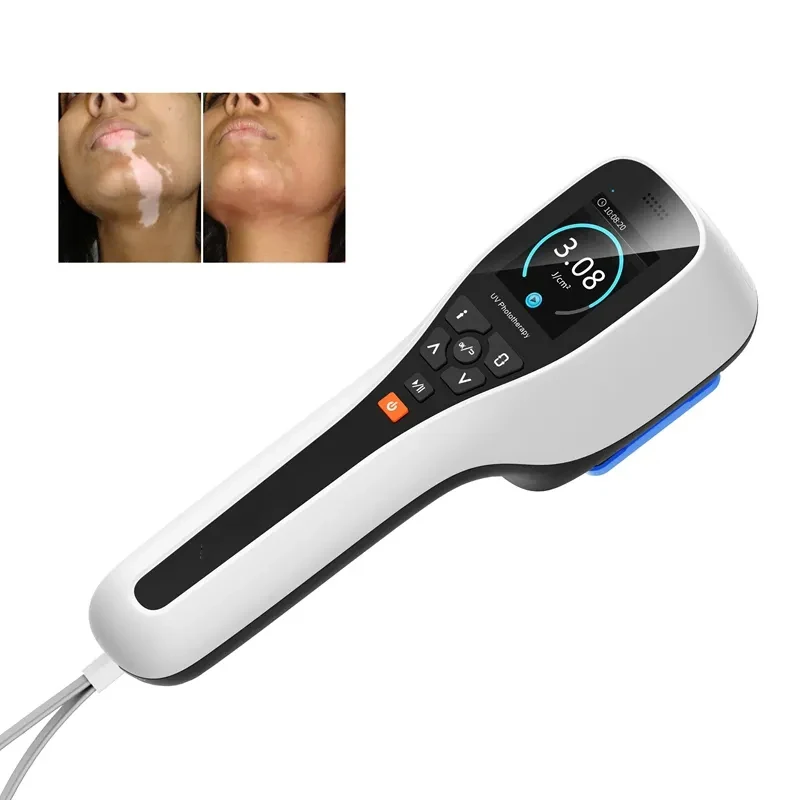 Mini Portable Psoriasis Vitiligo Treatment Lamp Uv 311nm Excimer Laser 308nm Uvb Led Phototherapy 308 nm vitiligo lamp