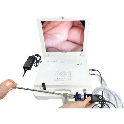 17 дюймов 4 в 1 эндоскопическая hd-камера портативный медицинский эндоскоп 720p камера для мобильного медицинского обслуживания