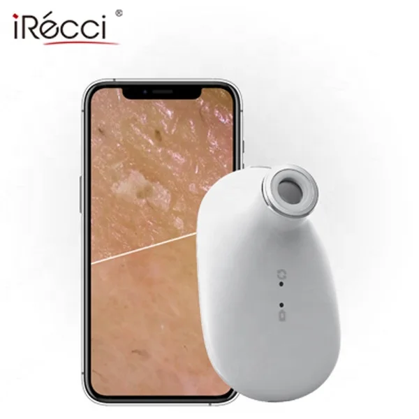 iRecci facial skin pigment scanner analysis device digital face skin dsiagnosis portable handheld skin scanner analyzer for beau