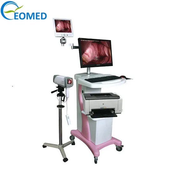 Digital HD Video Colposcope detect vulva, vagina, cervical disease diagnosis and inspection DVC5004
