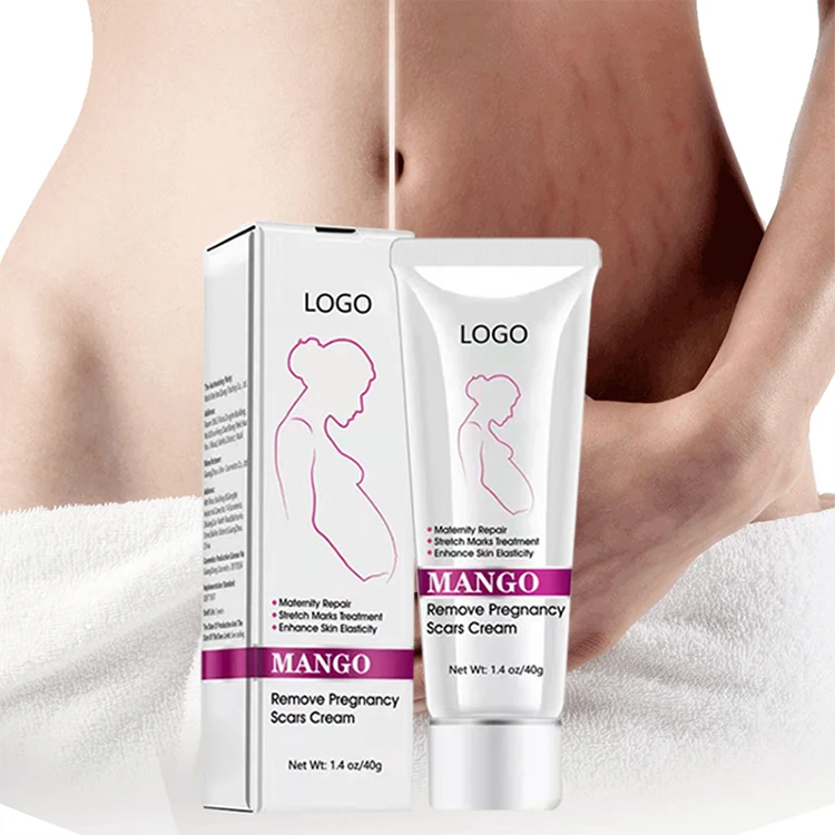 Wholesale Mango Stretch Mark Cream For Pregnancy Repair Scar Slack Line Abdomen Stretch Marks and Scar Removal Cream