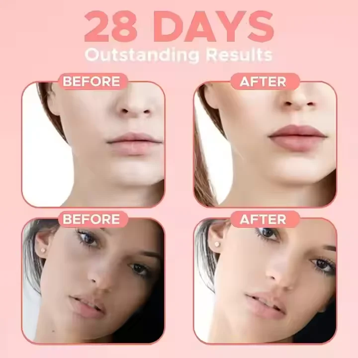 LIFITT Private Label Anti-Aging Vitamin C E Nicotinamide Serum with Hyaluronic Acid 5 1 Brightening Face Oil for Body Glowing