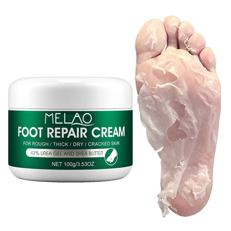 Best Hand And Foot Whitening Cream Foot Cream Deep Repair Callus Remover Foot Peeling Cream For Cracked Heels