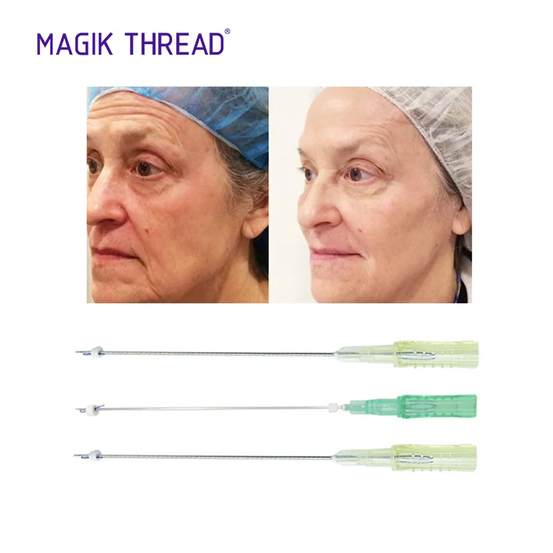 Magik Thread hilo de tensores collagen pdo thread cog 4D W blunt 19g 100mm lifting thread for lifting face and body