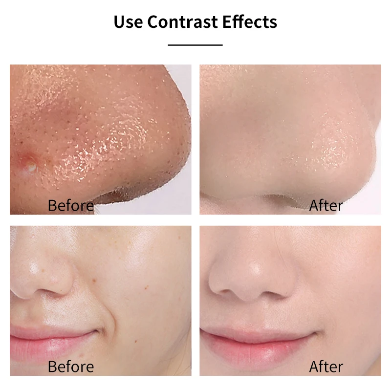 50 шт в наборе изготовленным на заказ логосом уход за кожей лица косметический продукт по уходу частная этикетка для против акне природные органические розовый каолиновая глина авокадо грязевая маска