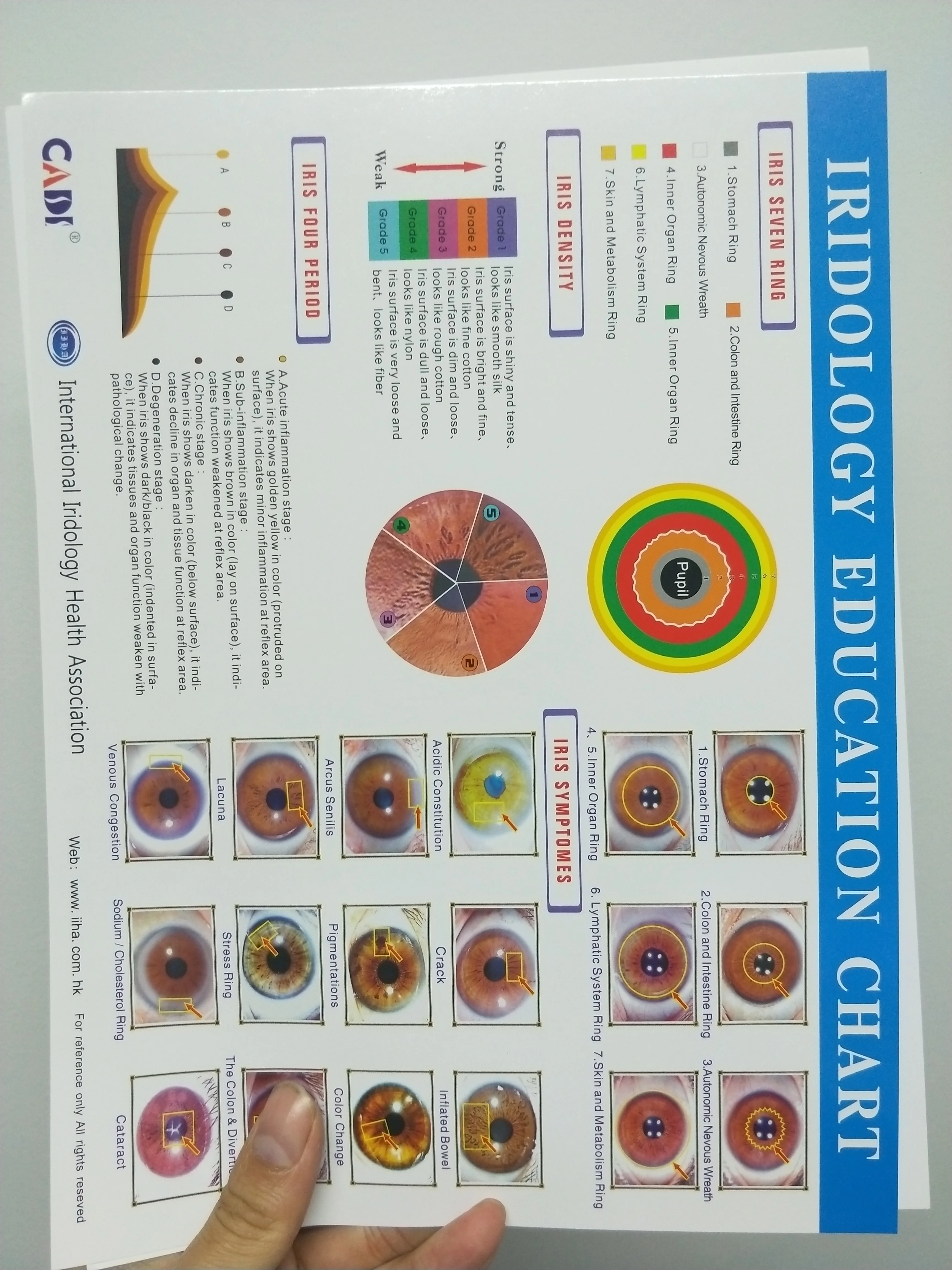 English spanish korean russian 12MP health analysis iris iriscope iridology camera with auto software