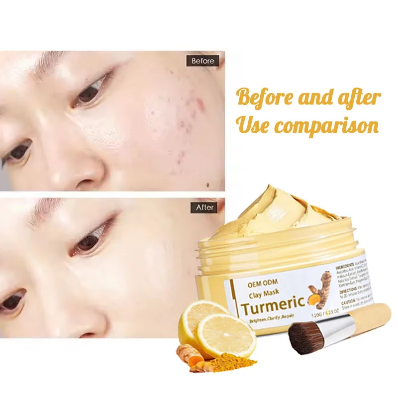 Private Label Turmeric Clay Mask Face Charcoal Deep Cleansing Blackhead Skincare Peel Off Anti Acne Turmeric Facial Mud Mask