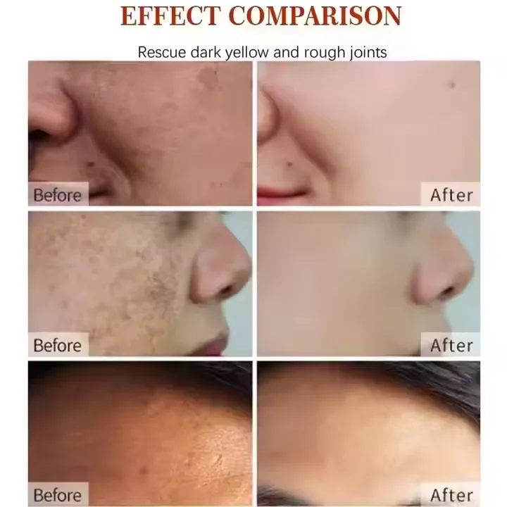 OVILZ Private Label customize moisturize Vitamin C and anti-aging retinol brightening best face skin cream